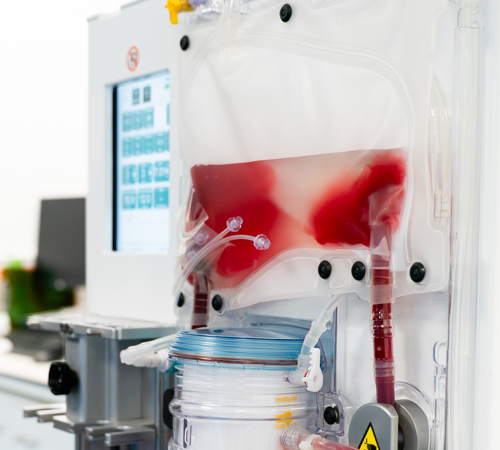 A photo of a blood bag during an operation. The photo is a still provided by OrganOx the company who won the 2025 MacRobert Award for their organ transport technology.